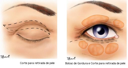 Região das pálpebras