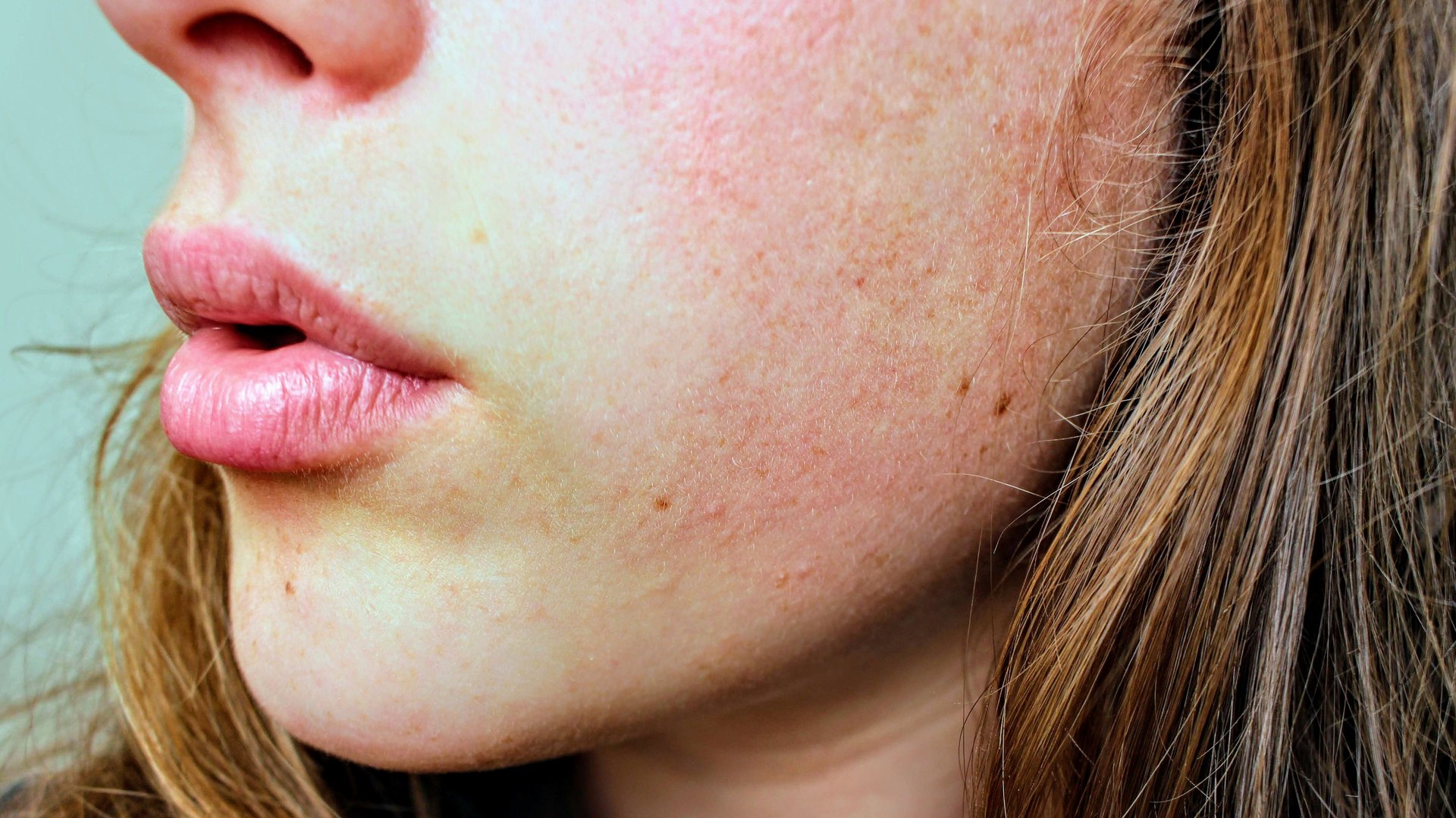 Lipoenxertia Facial
