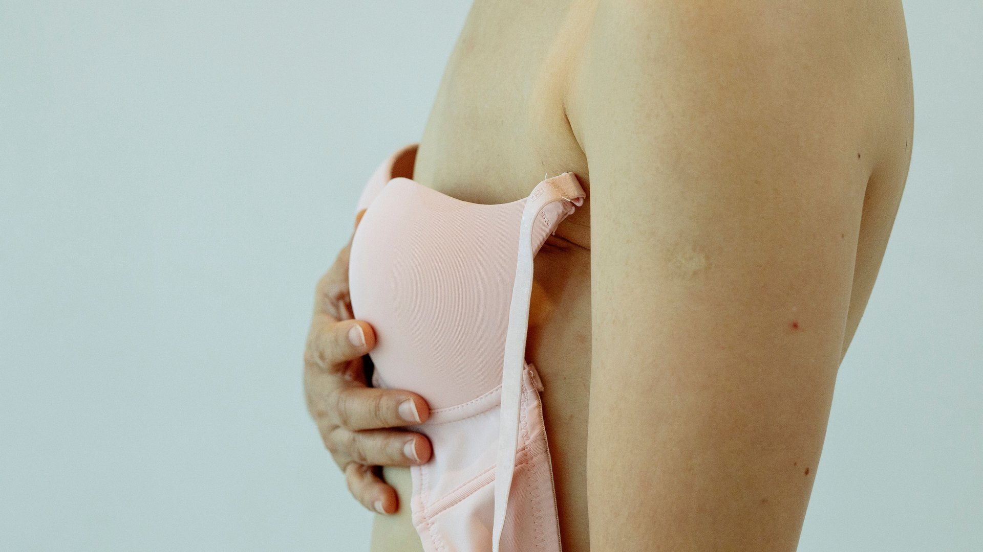Mamiloplastia