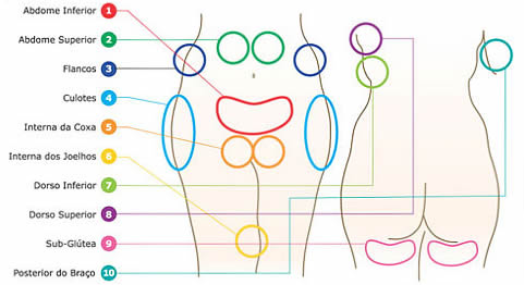 Regiões de lipoaspiração e lipoescultura