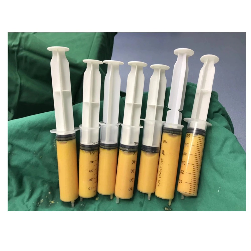 Enxerto de gordura corporal reparador