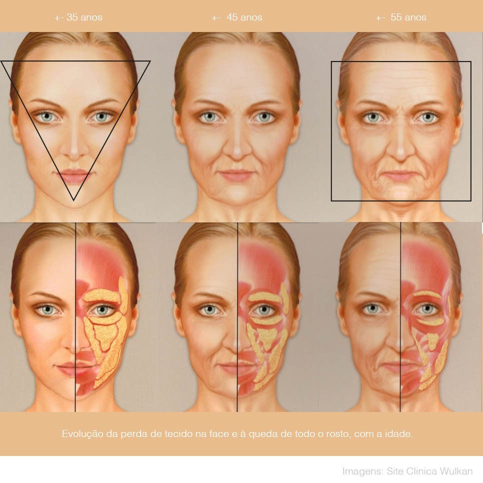 Compartimentos de gordura facial